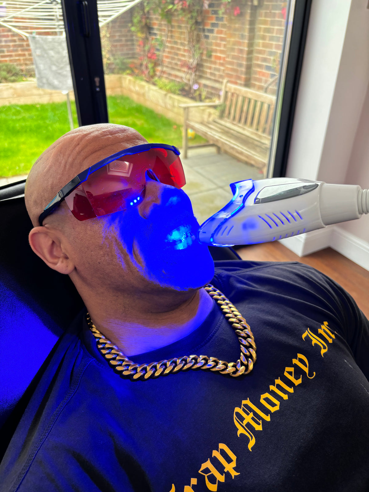 Teeth Whitening Sessions