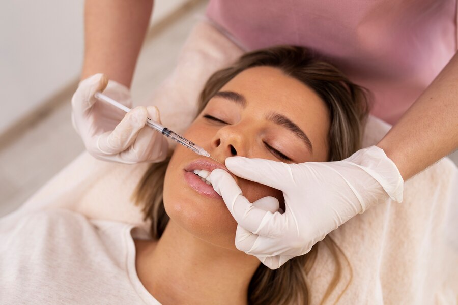 LIP FILLER -  ZYRA SKIN CLINIC