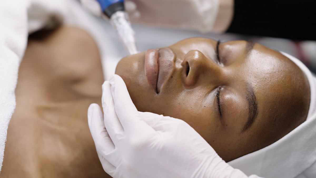 MICRONEEDLING FACIAL BRISTOL -  ZYRA SKIN CLINIC