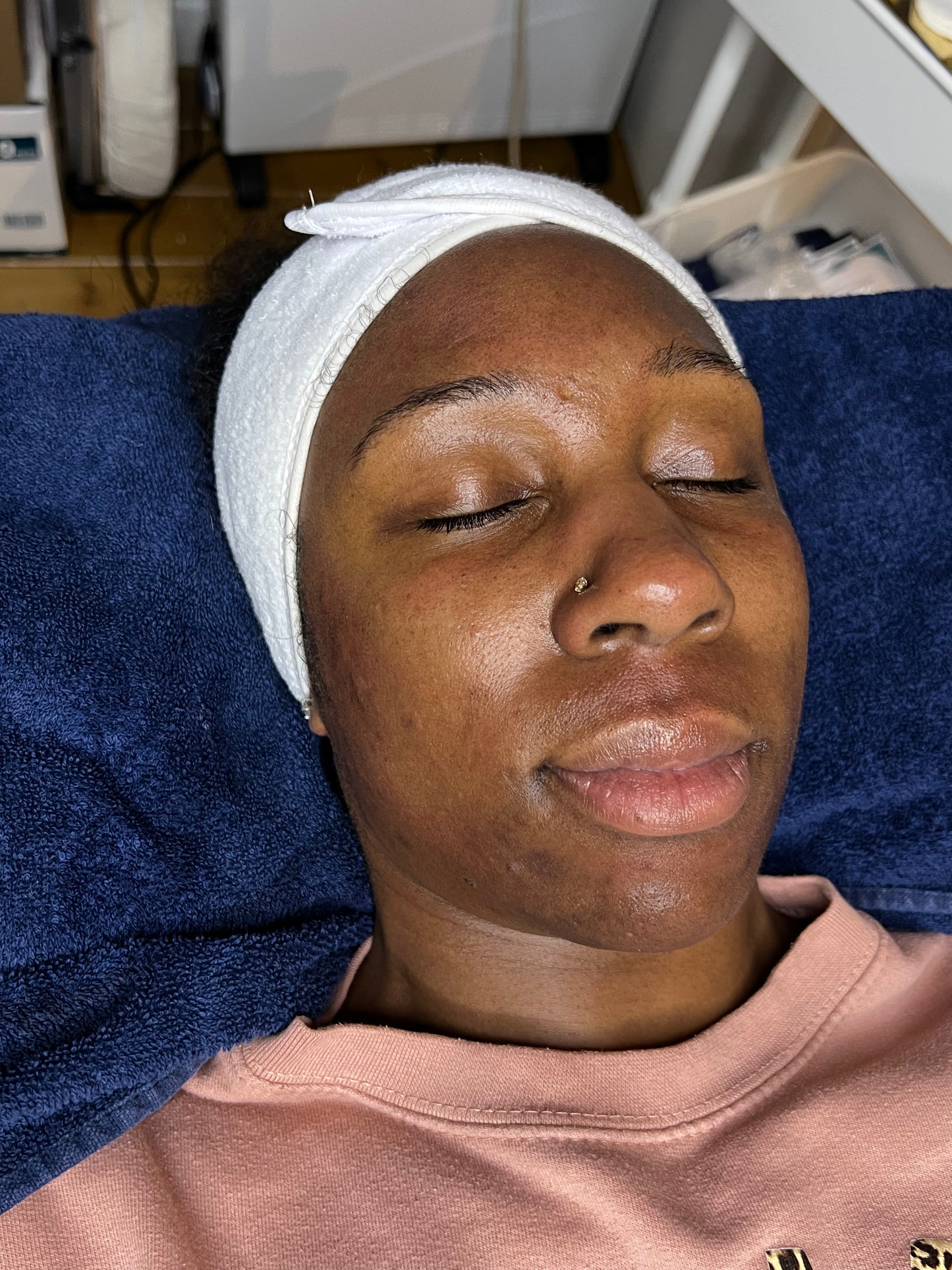 ULTIMATE FACIAL GLOW | FACIAL PACKAGES BRISTOL -  ZYRA SKIN CLINIC